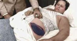 Anna Elizabete Hodžesa pēc meteorīta trāpījuma. Anna Elizabete Hodžesa pēc meteorīta trāpījuma.