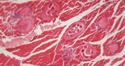 Trichinella spiralis kāpuri muskuļu audos zem mikroskopa.