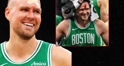 Kristaps Porziņģis saņēma sitienu no "Magic" centra Gogas Bitadzes. 