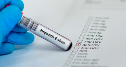 Kā radies vīrusa hepatīts E?