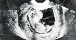 Cilvēka embrijs. Cilvēka embrijs.