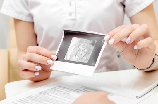 Visām sievietēm vismaz reizi gadā ieteicams veikt ultrasonogrāfiju, lai izslēgtu gan labdabīgu, gan ļaundabīgu olnīcu cistu esamību.