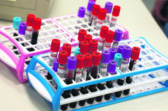 Eiropas Parlamenta deputāti vēlas īpašu ES veselības finansējumu, lai turpinātu atbalstīt pretvēža iniciatīvas un pētniecību.