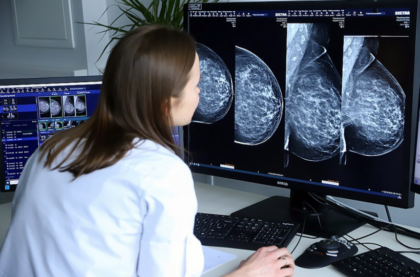 Radiologa darbs ir ļoti atkarīgs no radiologa asistenta profesionalitātes, jo tieši viņš ir tas, kurš nodrošina nepieciešamā krūts attēla kvalitāti.
