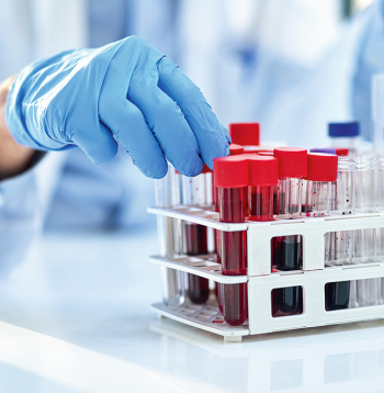 Asins analīzes. Ilustratīvs attēls.