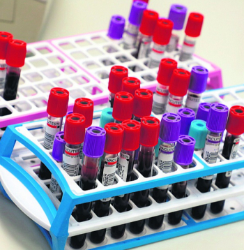 Eiropas Parlamenta deputāti vēlas īpašu ES veselības finansējumu, lai turpinātu atbalstīt pretvēža iniciatīvas un pētniecību.