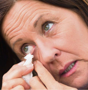 Vējainā dienā acīs var iekļūt smiltis un dažādi gruži. Vējainā dienā acīs var iekļūt smiltis un dažādi gruži.