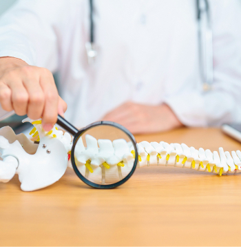 Nereti sāpju cēlonis ir kāda no mugurkaulāja deģeneratīvajām slimībām, kuru dēļ notiek pārmaiņas starpskriemeļu locītavās un starpskriemeļu atveres sašaurināšanās, tādēļ tiek nospiestas nerva saknītes tās izejas vietā starp skriemeļiem.