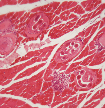 Trichinella spiralis kāpuri muskuļu audos zem mikroskopa.