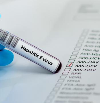 Kā radies vīrusa hepatīts E?