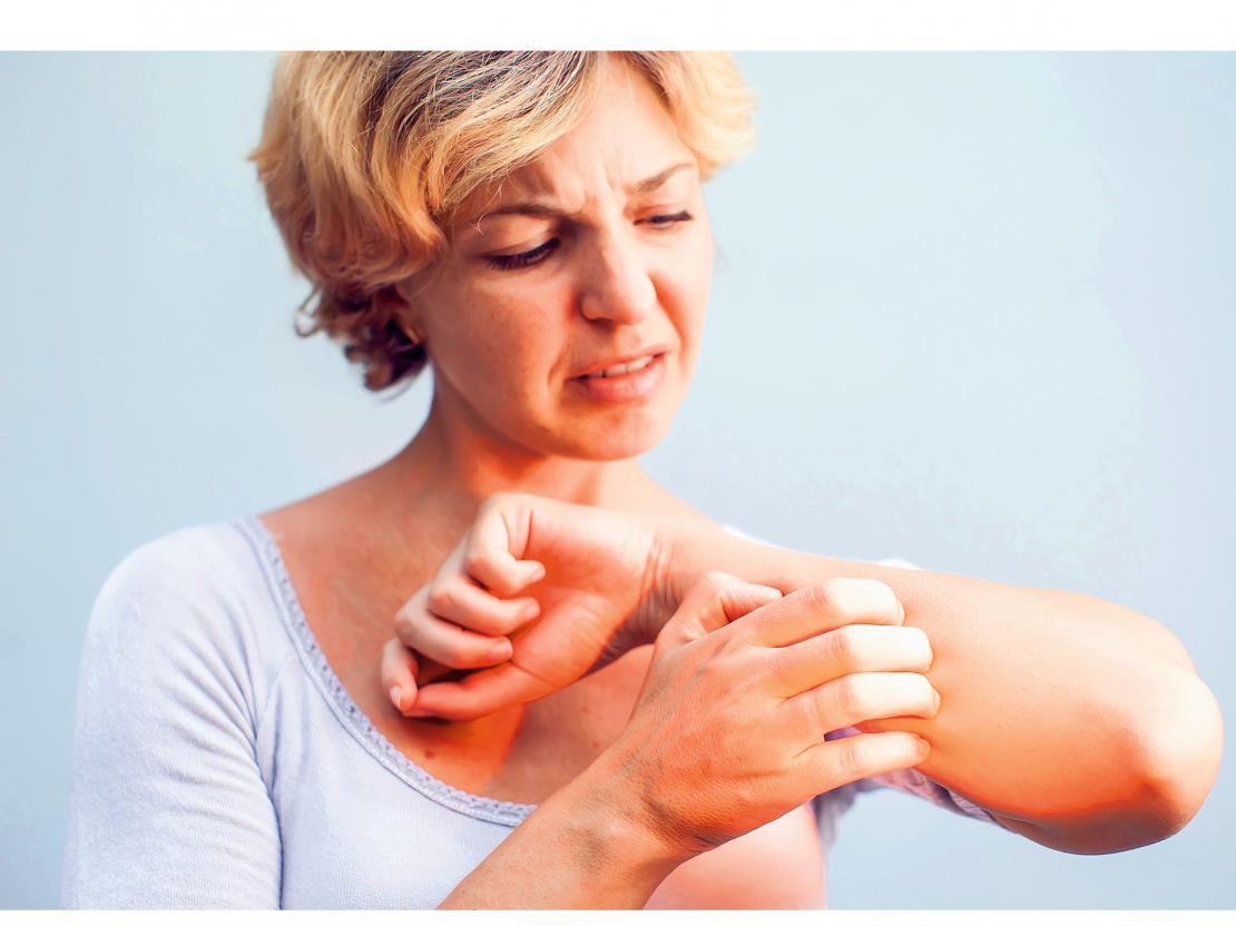 Atopiskā dermatīta gadījumā ar pašārstēšanos nodarboties nedrīkst.