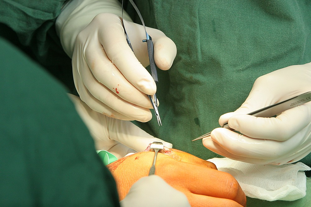 Veselības ministrija ir norādījusi, ka, vērtējot ķirurģisko aktivitāti slimnīcās, secināts, ka tā pat viena līmeņa slimnīcās esot ļoti atšķirīga. Zema ķirurģiskā aktivitāte pamatā esot otrā līmeņa slimnīcās. Tā neļaujot nodrošināt ārstam pietiekamu pieredzi, kas savukārt varot negatīvi ietekmēt sniegto pakalpojumu kvalitāti.