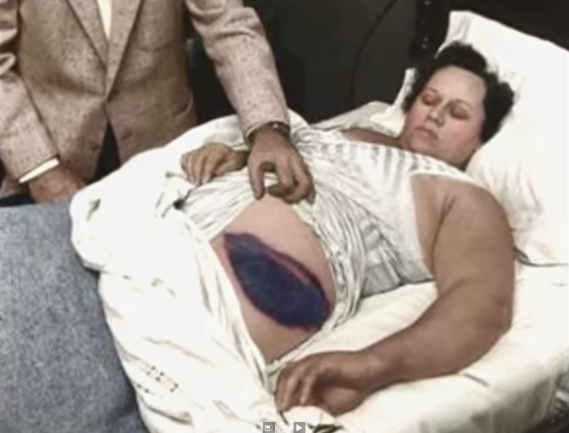 Anna Elizabete Hodžesa pēc meteorīta trāpījuma.