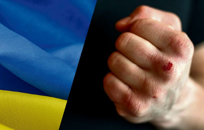 "Viņš gribēja mani nogalināt. Vienkārši kā ukraini – ņemt un nogalināt..." saka cietušais. Uzbrucējs esot pārmetis Serhijam, ka viņa dēls frontē nogalinot krievus.