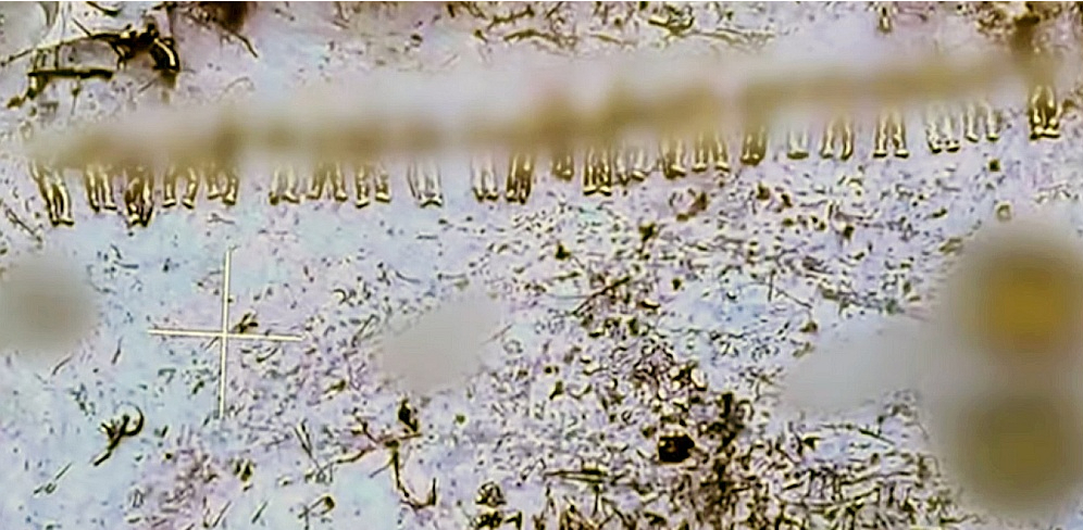 Ekrānuzņēmums no sociālajos tīklos izplatītā Ukrainas armijas drona video Kurskas apgabalā, kur redzami kritušie ziemeļkorejieši.