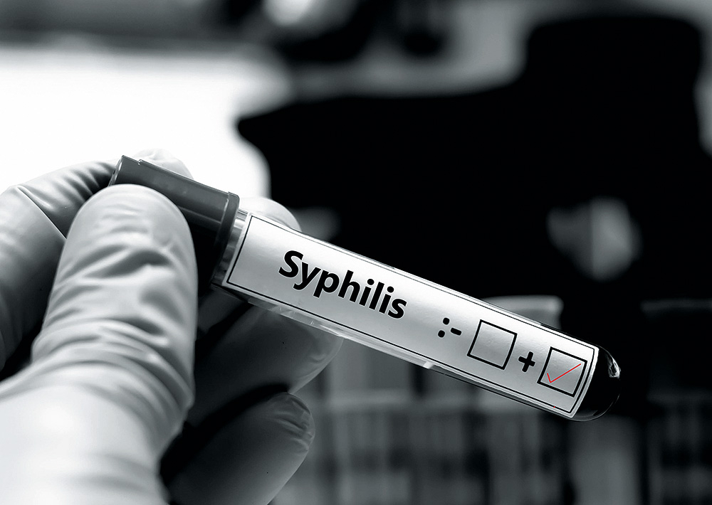 1932. gadā praktiski visa pasaule bija nostājusies cīņā pret riebīgo venerisko slimību sifilisu.