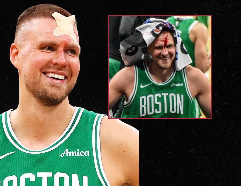 Kristaps Porziņģis saņēma sitienu no "Magic" centra Gogas Bitadzes. 