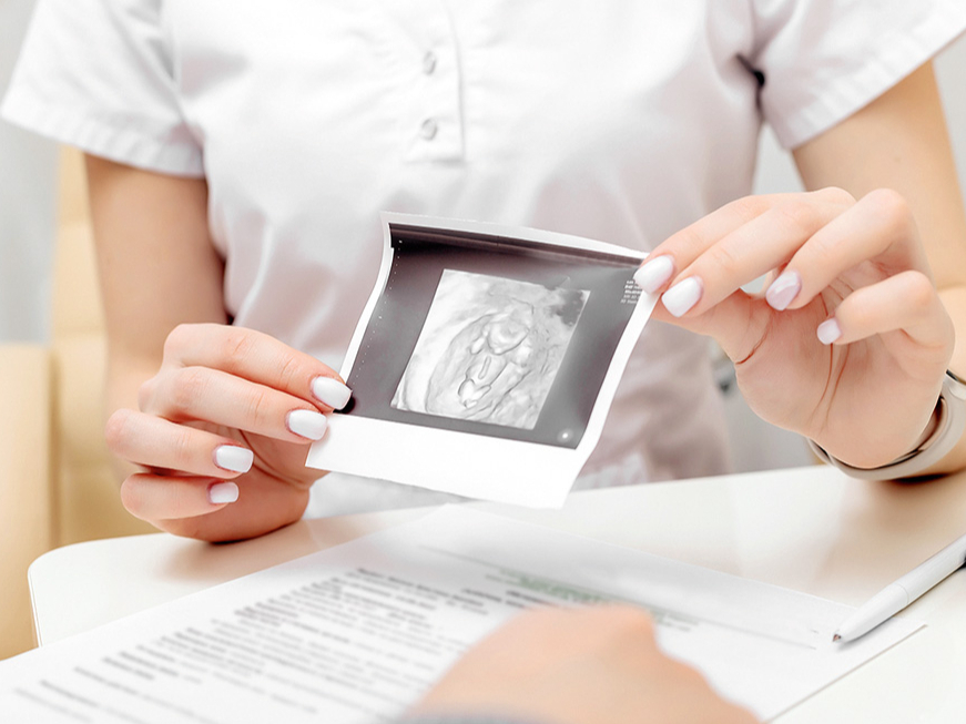 Visām sievietēm vismaz reizi gadā ieteicams veikt ultrasonogrāfiju, lai izslēgtu gan labdabīgu, gan ļaundabīgu olnīcu cistu esamību.