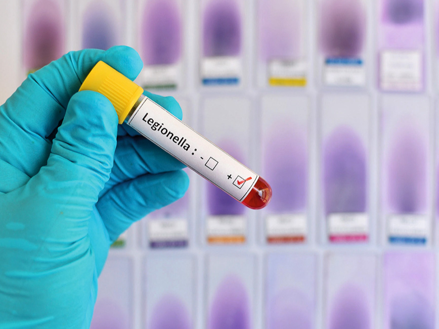 Ilustratīvs attēls.