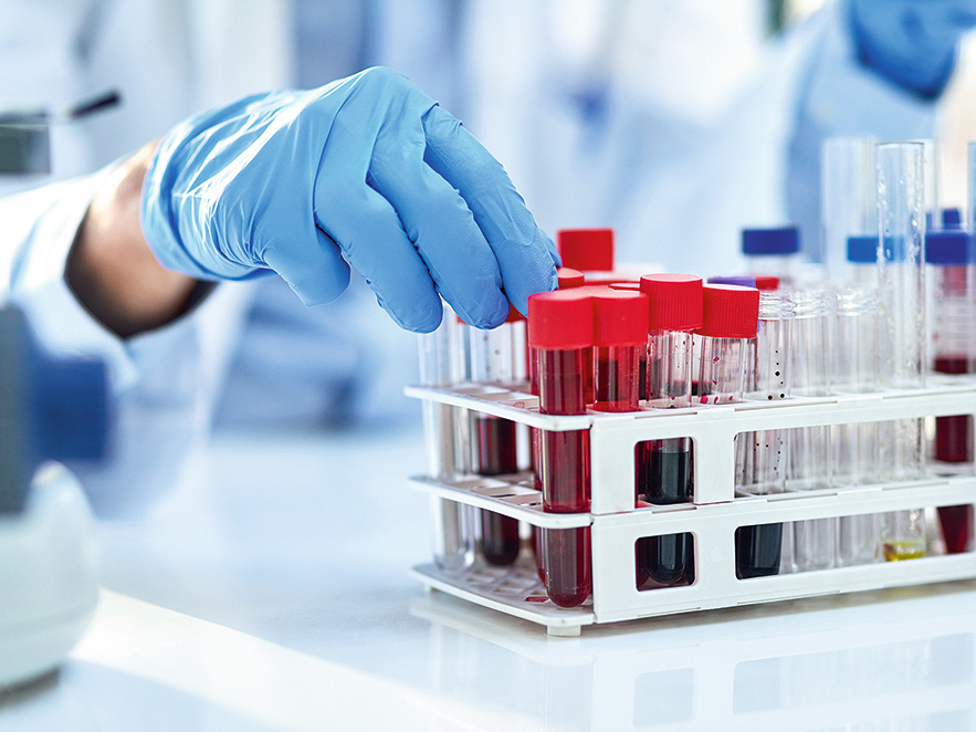 Asins analīzes. Ilustratīvs attēls.