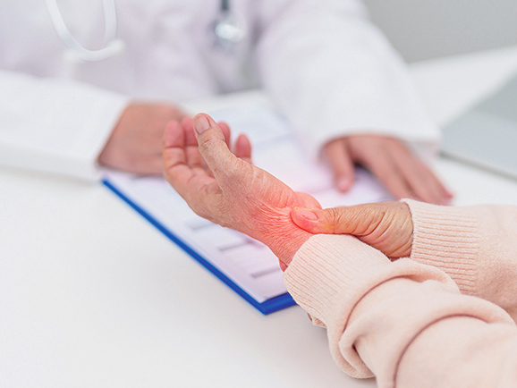 Podagra rodas, kad urīnskābe kristālu veidā sāk izgulsnēties audos, galvenokārt locītavās. 