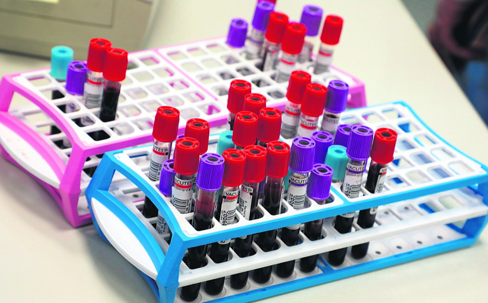 Eiropas Parlamenta deputāti vēlas īpašu ES veselības finansējumu, lai turpinātu atbalstīt pretvēža iniciatīvas un pētniecību.