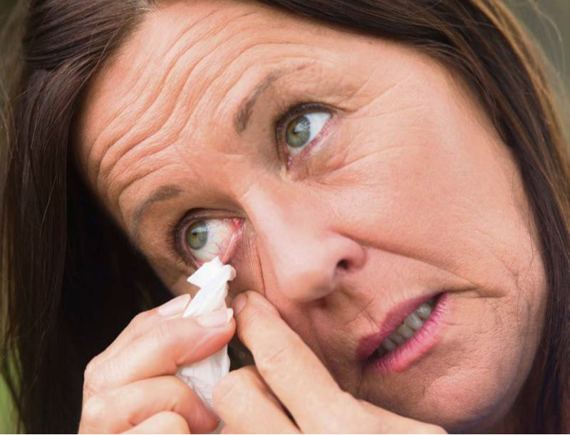 Vējainā dienā acīs var iekļūt smiltis un dažādi gruži.