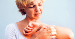 Atopiskā dermatīta gadījumā ar pašārstēšanos nodarboties nedrīkst. Atopiskā dermatīta gadījumā ar pašārstēšanos nodarboties nedrīkst.