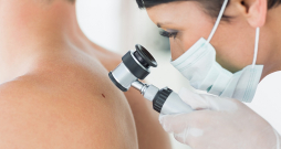 Aizdomīgus ādas veidojumus vajag parādīt dermatologam. Aizdomīgus ādas veidojumus vajag parādīt dermatologam.