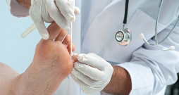 Paraugu sēnīšu infekcijas diagnostikai noņems dermatologs vai podologs. Paraugu sēnīšu infekcijas diagnostikai noņems dermatologs vai podologs.