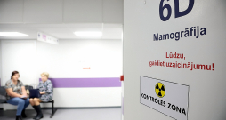 Nacionālais veselības dienests 2023. gadā izsūtīja 140 tūkstošus uzaicinājuma vēstuļu veikt šo bezmaksas pārbaudi, bet atsaucās tikai 50 531 sieviešu. Nacionālais veselības dienests 2023. gadā izsūtīja 140 tūkstošus uzaicinājuma vēstuļu veikt šo bezmaksas pārbaudi, bet atsaucās tikai 50 531 sieviešu.