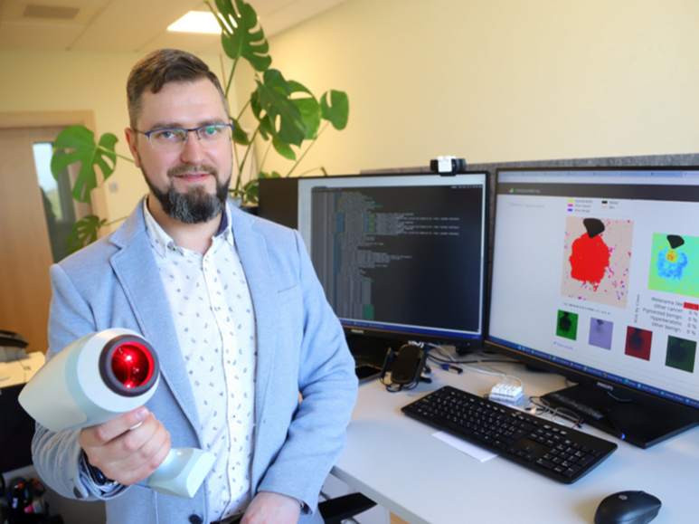 Rīgas Tehniskās universitātes Lietišķo datorsistēmu institūta vadošais pētnieks inženierzinātņu doktors Dmitrijs Bļizņuks demonstrē ierīci, kas dažu sekunžu laikā nosaka, vai āda ir melanomas skarta. Ierīces iegūtais rezultāts teju uzreiz parādās
datora ekrānā.