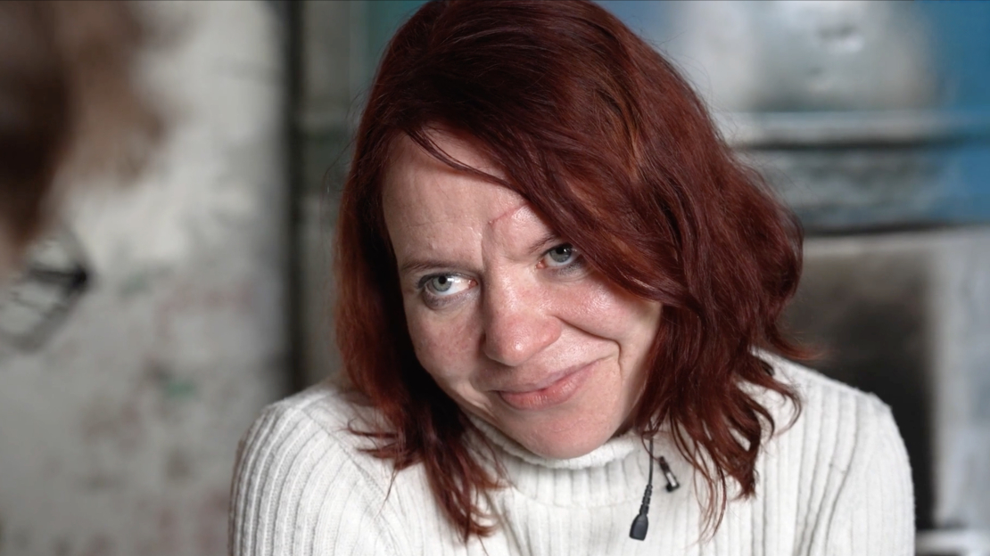 "Ērkšķu" Ilze.