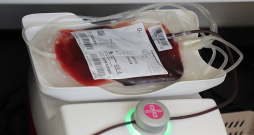 Valsts asinsdonoru centrs donorus gaida visās pastāvīgajās ziedošanas vietās.