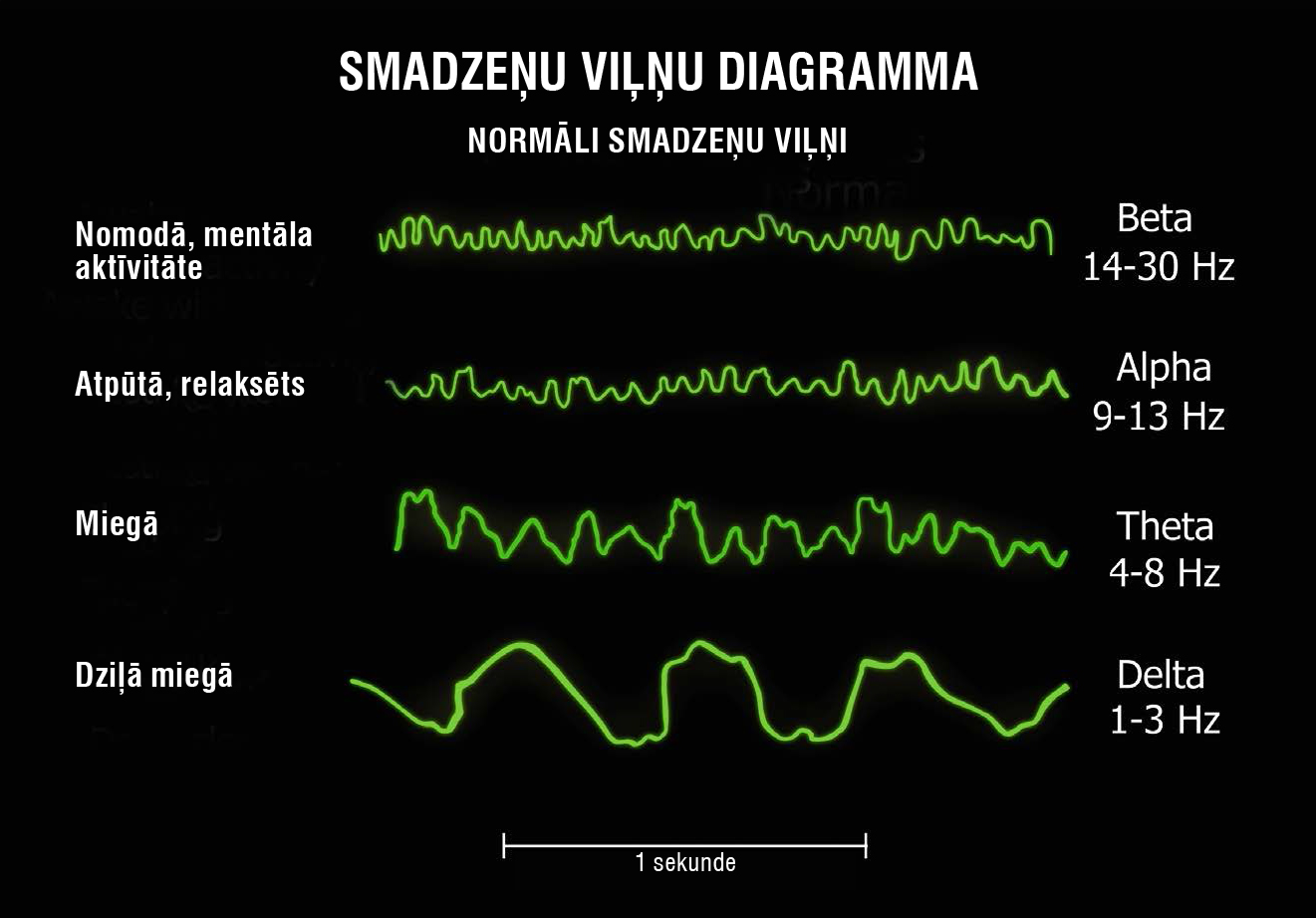 Smadzeņu viļņu diagramma